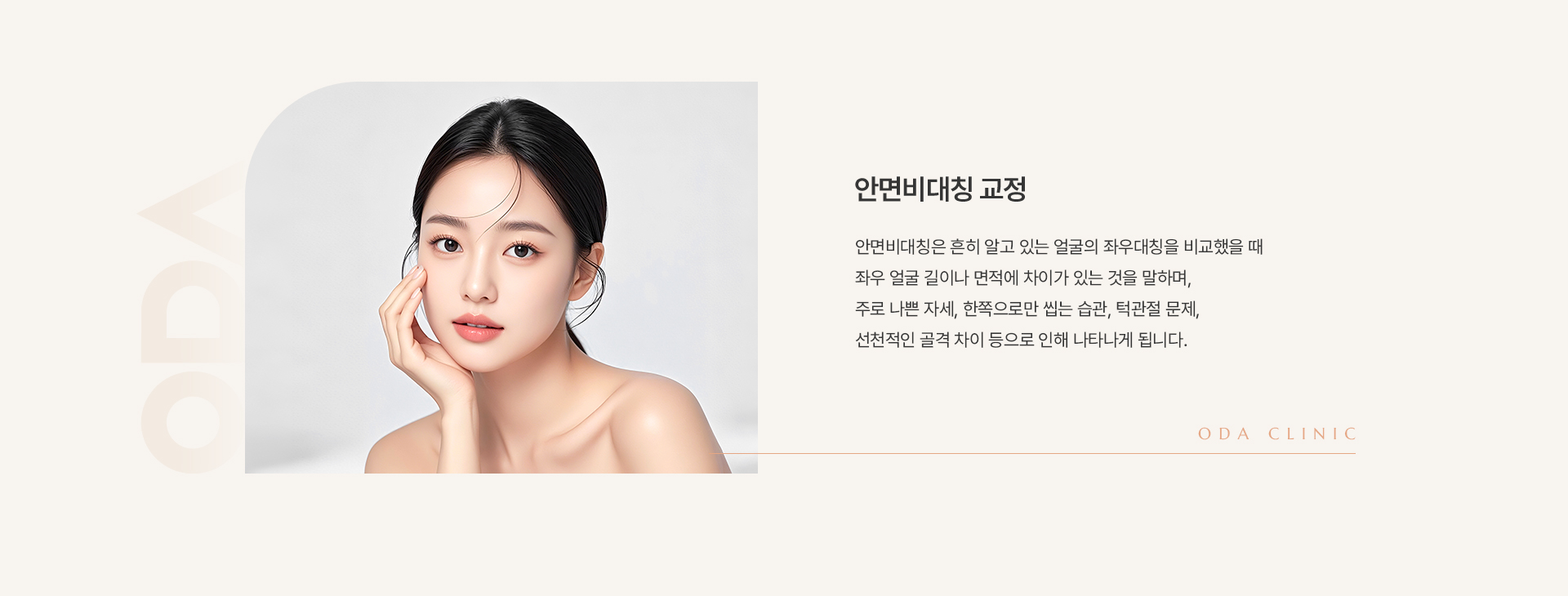 안면비대칭 교정 상세01